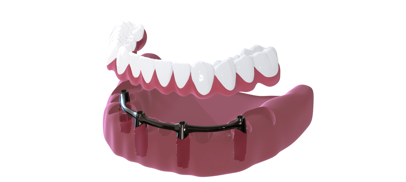 Картинка 3D модели